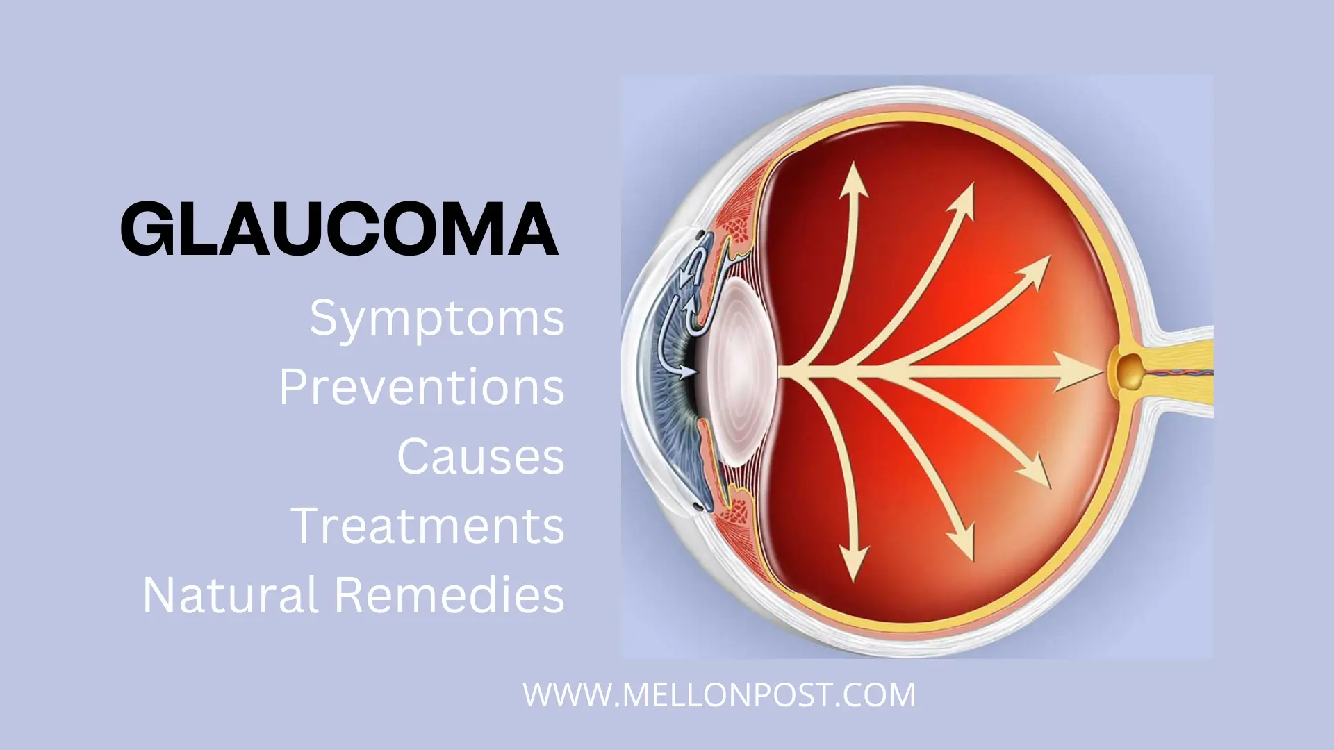 What is Glaucoma. Glaucoma Causes and Treatment