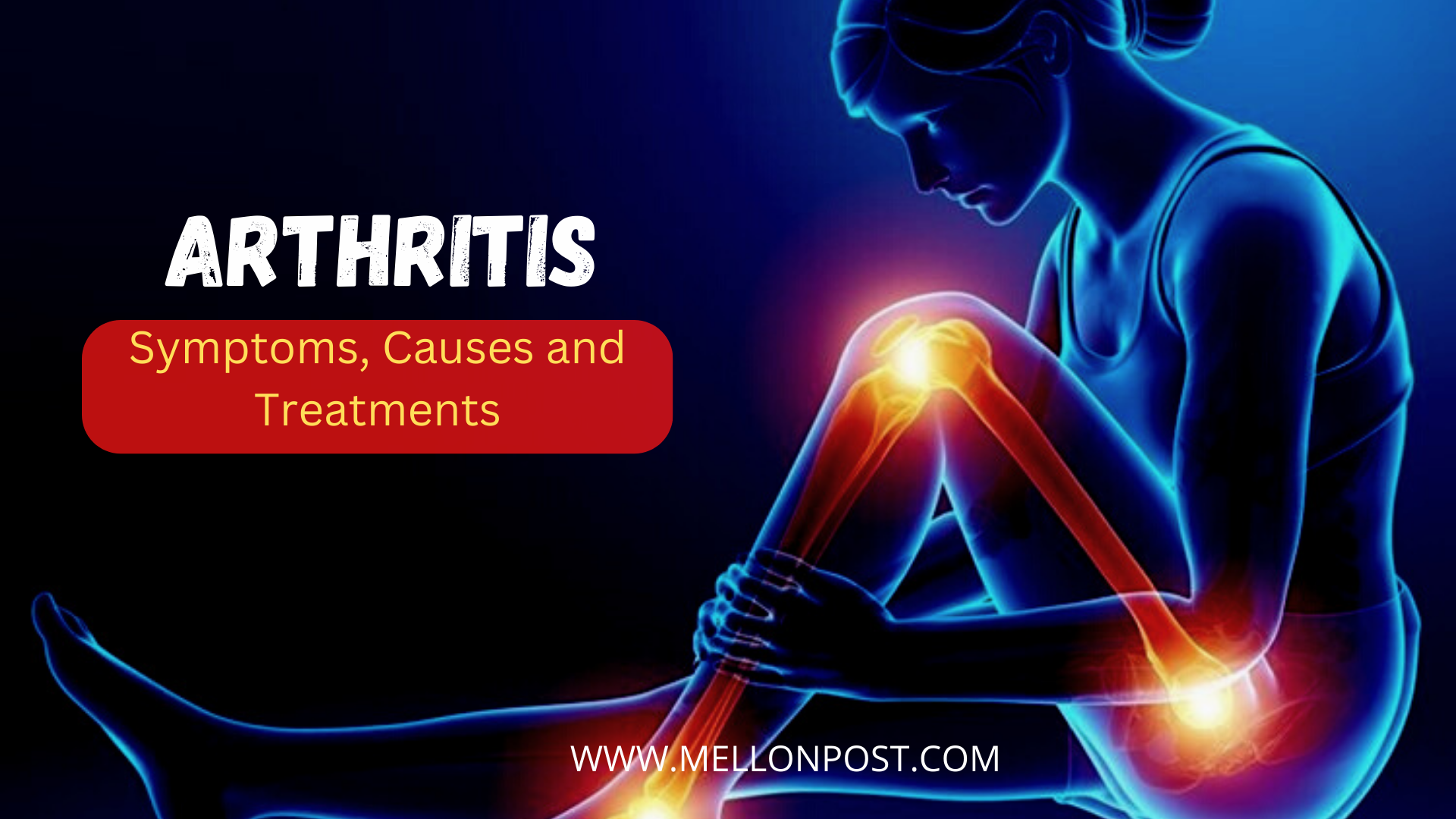 What is Arthritis: Symptoms, Causes, and Treatment