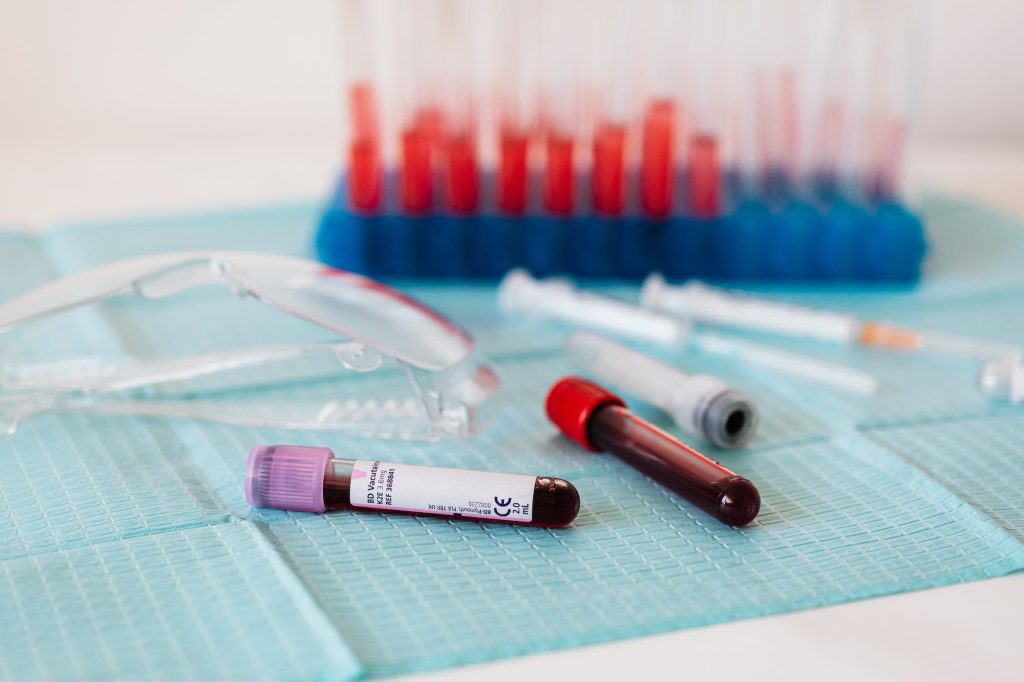 full vials of blood near various medical equipment for taking blood